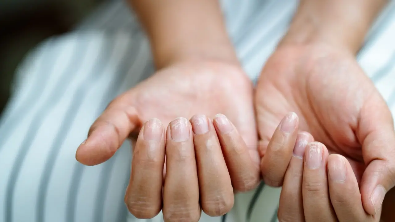 Unghie fragili che si spezzano, cosa fare? Ecco il trattamento rinforzante da fare a casa